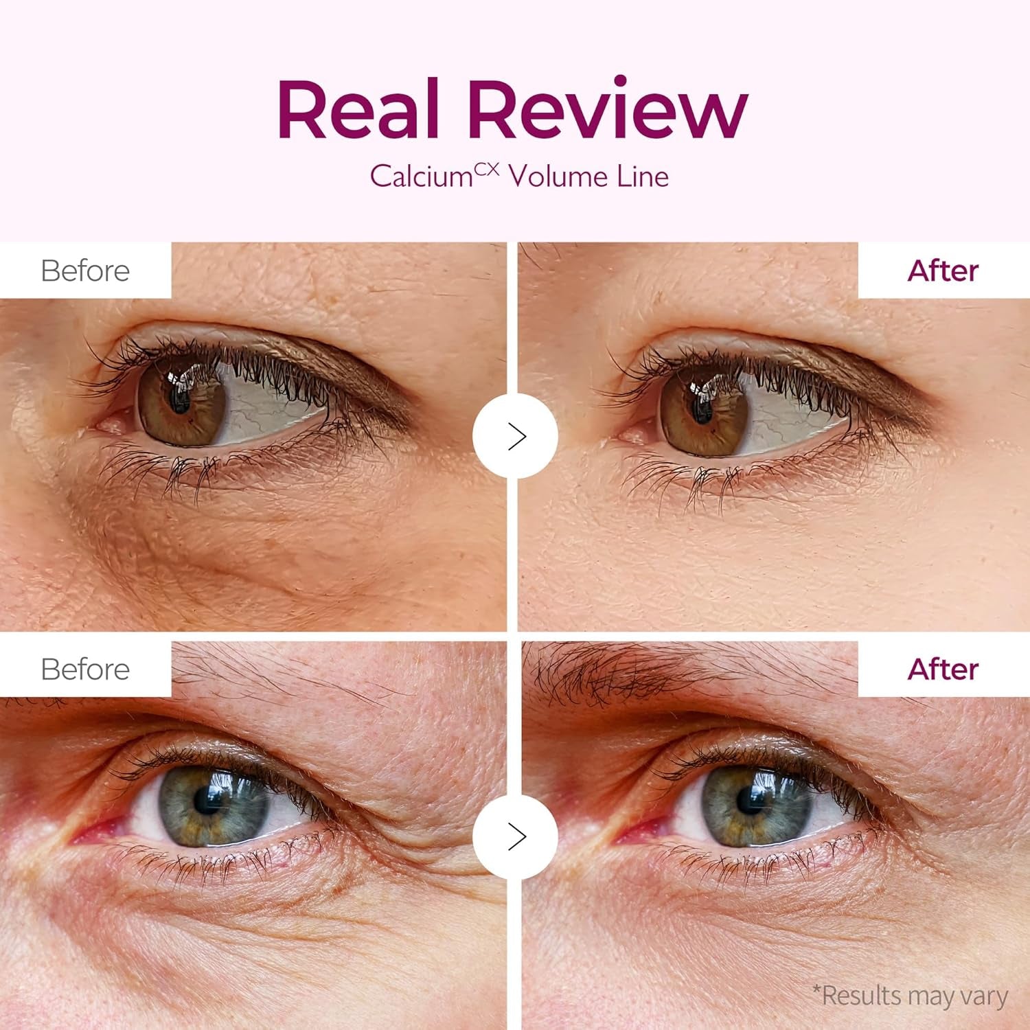 Cemenrete Calcium Volume Eye Patches (60 Patches) – under Eye Patches for Dark Circles & Puffiness, Anti-Wrinkle Eye Mask for Fine Lines, Firming & Elasticity Boosting K-Beauty Skincare